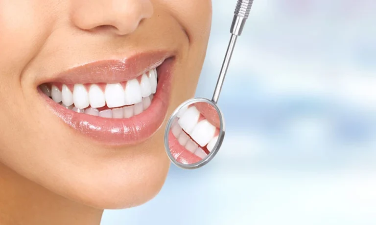 Temporary Stabilization For Fractured Teeth: Protecting The Area Until Repair